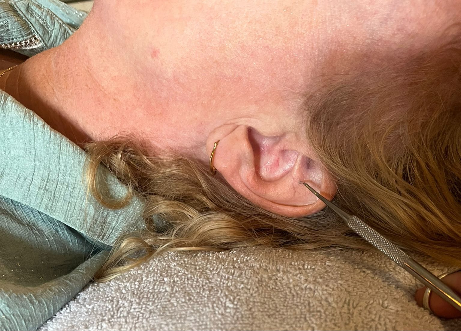 Een vergelijking tussen Chinese en Westerse benaderingen van ooracupunctuur (auriculotherapie)